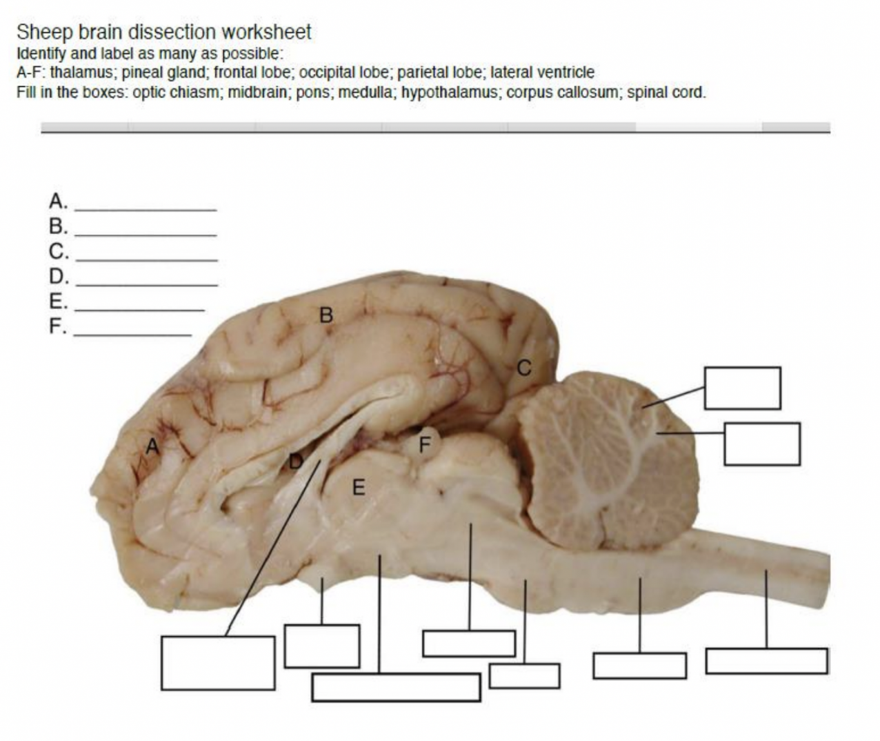 Solved Sheep brain dissection worksheet Identify and label  Chegg